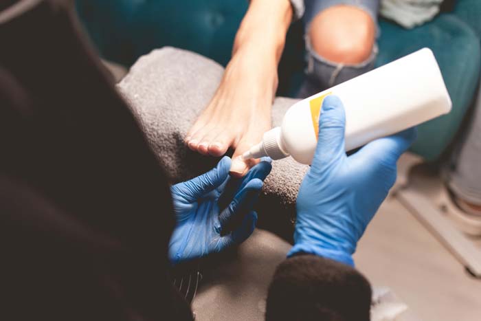 Tratamiento de uñas con hongos en Móstoles