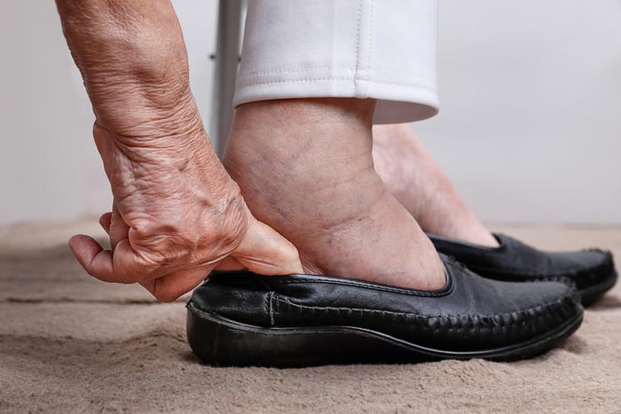 Pie diabético en Móstoles | Prevención y cuidado podológico
